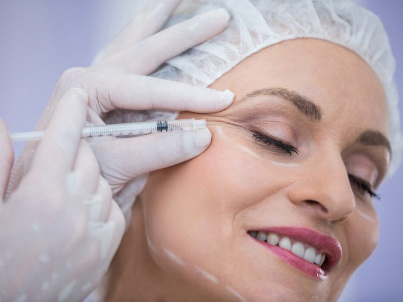 mulher-com-rosto-marcado-recebendo-injecao-de-botox_107420-74124